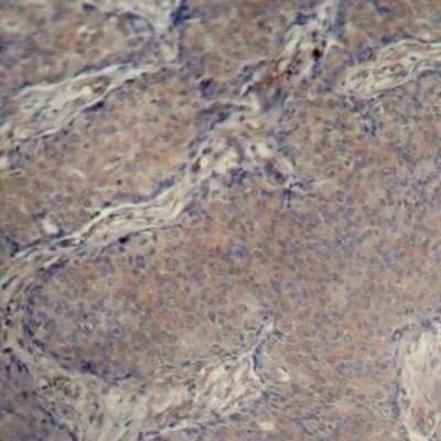 Immunohistochemistry-Paraffin: MRCL3 [p Ser18] Antibody - BSA Free [NBP3-05425]
